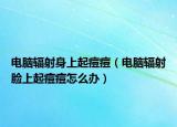 电脑辐射身上起痘痘（电脑辐射脸上起痘痘怎么办）