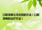 口腔溃疡立马见效的方法（口腔溃疡的治疗方法）