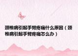 颈椎病引起手臂疼痛什么原因（颈椎病引起手臂疼痛怎么办）