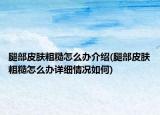 腿部皮肤粗糙怎么办介绍(腿部皮肤粗糙怎么办详细情况如何)