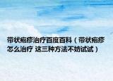 带状疱疹治疗百度百科（带状疱疹怎么治疗 这三种方法不妨试试）