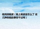 脸局部起皮（脸上起皮是怎么了 这几种伤脸的事你干过吗）