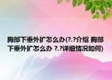 胸部下垂外扩怎么办(?.?介绍 胸部下垂外扩怎么办 ?.?详细情况如何)