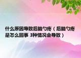 什么原因导致后脑勺疼（后脑勺疼是怎么回事 3种情况会导致）