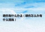 晒伤有什么办法（晒伤怎么办有什么措施）