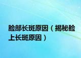 脸部长斑原因（揭秘脸上长斑原因）