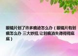 眼镜片划了许多痕迹怎么办（眼镜片有划痕怎么办 三大妙招,让划痕消失得彻彻底底）