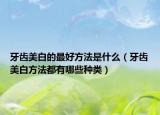 牙齿美白的最好方法是什么（牙齿美白方法都有哪些种类）