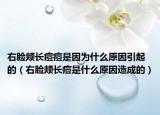右脸颊长痘痘是因为什么原因引起的（右脸颊长痘是什么原因造成的）