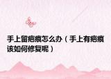 手上留疤痕怎么办（手上有疤痕该如何修复呢）