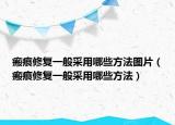 瘢痕修复一般采用哪些方法图片（瘢痕修复一般采用哪些方法）
