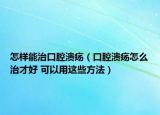 怎样能治口腔溃疡（口腔溃疡怎么治才好 可以用这些方法）