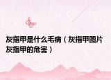 灰指甲是什么毛病（灰指甲图片 灰指甲的危害）