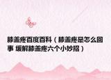 膝盖疼百度百科（膝盖疼是怎么回事 缓解膝盖疼六个小妙招）