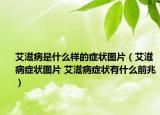 艾滋病是什么样的症状图片（艾滋病症状图片 艾滋病症状有什么前兆）