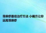 荨麻疹最佳治疗方法 小偏方让你远离荨麻疹