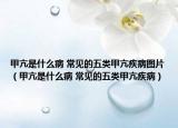 甲亢是什么病 常见的五类甲亢疾病图片（甲亢是什么病 常见的五类甲亢疾病）