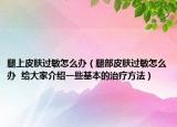 腿上皮肤过敏怎么办（腿部皮肤过敏怎么办  给大家介绍一些基本的治疗方法）