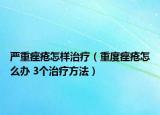 严重痤疮怎样治疗（重度痤疮怎么办 3个治疗方法）