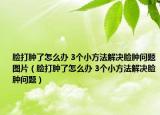 脸打肿了怎么办 3个小方法解决脸肿问题图片（脸打肿了怎么办 3个小方法解决脸肿问题）