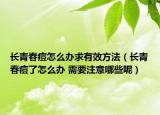 长青春痘怎么办求有效方法（长青春痘了怎么办 需要注意哪些呢）