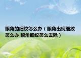 眼角的细纹怎么办（眼角出现细纹怎么办 眼角细纹怎么去除）