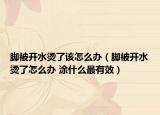 脚被开水烫了该怎么办（脚被开水烫了怎么办 涂什么最有效）