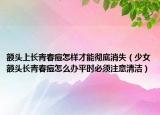 额头上长青春痘怎样才能彻底消失（少女额头长青春痘怎么办平时必须注意清洁）