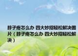 脖子疼怎么办 四大妙招轻松解决图片（脖子疼怎么办 四大妙招轻松解决）