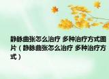 静脉曲张怎么治疗 多种治疗方式图片（静脉曲张怎么治疗 多种治疗方式）