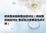 郑爽整容前和整容后对比（郑爽整容前后对比 整容后注意事项马虎不得）
