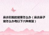 鼻炎引起的堵塞怎么办（鼻炎鼻子堵怎么办有以下六种类型）