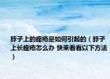 脖子上的痤疮是如何引起的（脖子上长痤疮怎么办 快来看看以下方法）