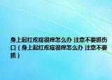 身上起红疙瘩很痒怎么办 注意不要抓伤口（身上起红疙瘩很痒怎么办 注意不要抓）