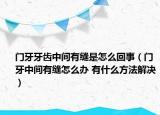 门牙牙齿中间有缝是怎么回事（门牙中间有缝怎么办 有什么方法解决）