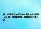 腿上皮肤粗糙如何改善（腿上皮肤粗糙怎么办 腿上皮肤粗糙的主要原因和解决办法）