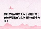 皮肤干燥掉皮怎么办才能有效啊（皮肤干燥脱皮怎么办 五种改善小方法）