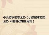 小儿得水痘怎么办（小孩起水痘怎么办 不能自己胡乱用药）