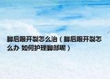 脚后跟开裂怎么治（脚后跟开裂怎么办 如何护理脚部呢）