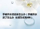 手被开水烫应该怎么办（手被开水烫了怎么办  处理方式有6种）