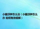 小腿浮肿怎么治（小腿浮肿怎么办 如何有效缓解）