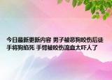 今日最新更新内容 男子被恶狗咬伤后徒手将狗掐死 手臂被咬伤流血太吓人了