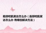 脸部咬肌发达怎么办（面部咬肌发达怎么办 有哪些解决方法）