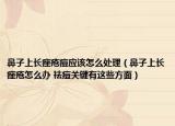 鼻子上长痤疮痘应该怎么处理（鼻子上长痤疮怎么办 祛痘关键有这些方面）