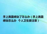 手上真菌感染了怎么办（手上真菌感染怎么办  个人卫生要注意）