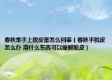 春秋季手上脱皮是怎么回事（春秋手脱皮怎么办 用什么东西可以缓解脱皮）