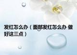 发红怎么办（面部发红怎么办 做好这三点）