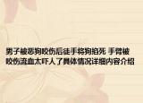 男子被恶狗咬伤后徒手将狗掐死 手臂被咬伤流血太吓人了具体情况详细内容介绍