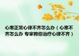 心率正常心律不齐怎么办（心率不齐怎么办 专家教你治疗心律不齐）