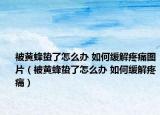 被黄蜂蛰了怎么办 如何缓解疼痛图片（被黄蜂蛰了怎么办 如何缓解疼痛）